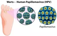HPV Warts: Harmless or Harmful?