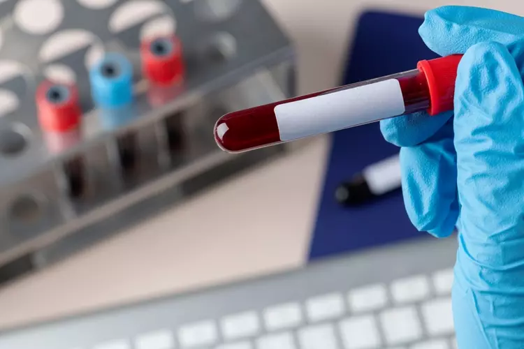 Blood Clots: What You Need to Know About Environmental Risks Photo Credit: by freepik.com