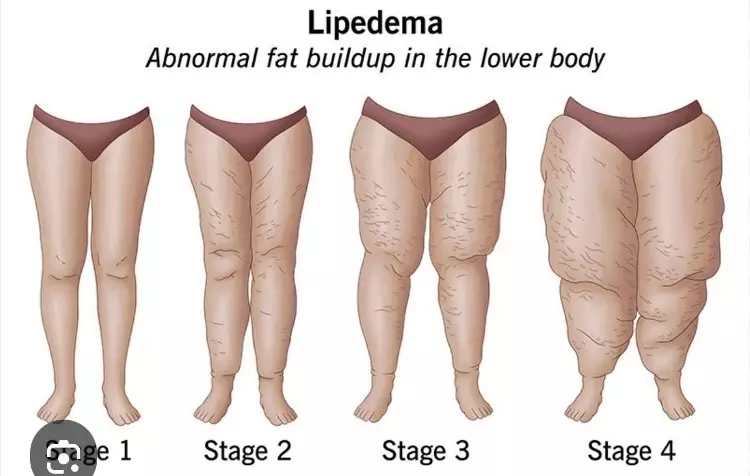 Photo Credit: from Cleveland Clinic