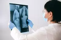Why is Lung Cancer on the Rise in Nonsmokers – Especially Women?