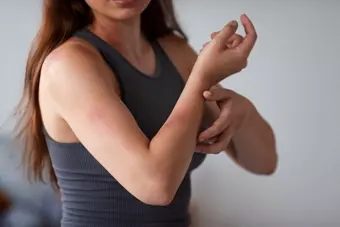 Top Strategies for Psoriasis Self-Care This Summer