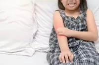 Psoriasis: A Skin Problem or a Gut-Skin Problem?